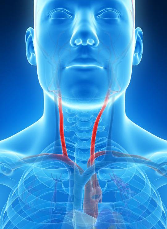 Дуплексное сканирование сонных артерий
