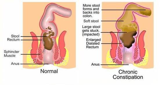 анатомия кишечника