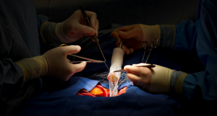 Дуплексное сканирование артерий нижних конечностей после операции